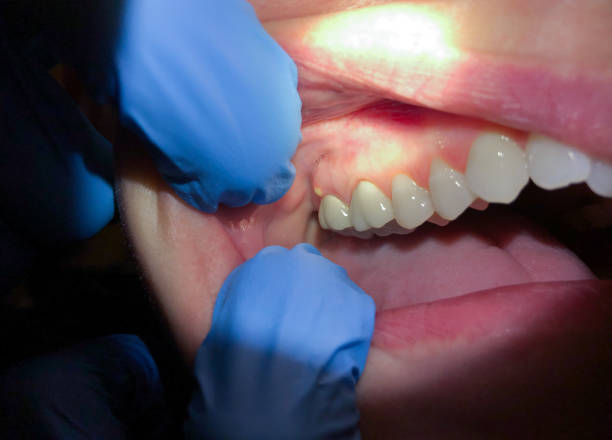 Best Emergency Dental Care for Trauma or Injury in Burnettown, SC