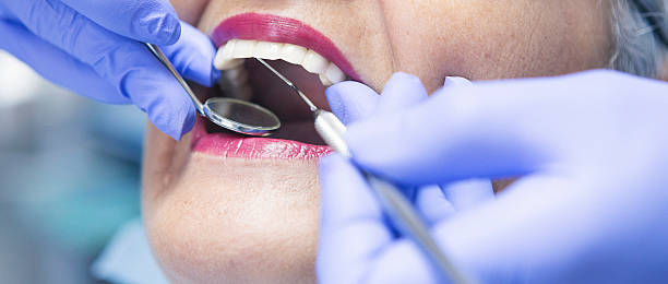 Best Emergency Tooth Extraction in Burnettown, SC